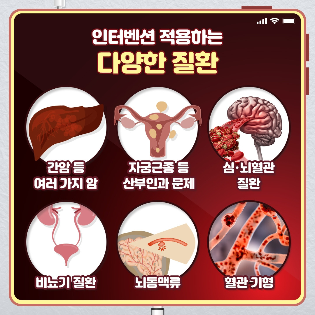 인터벤션_03.jpg