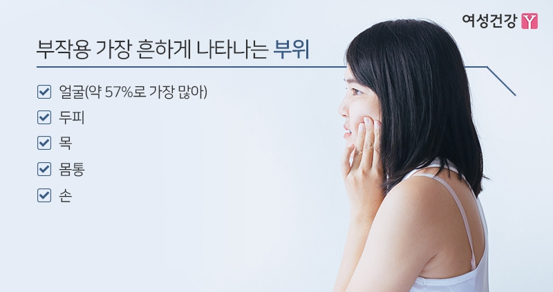 6.※부작용 가장 흔하게 나타나는 부위.jpg