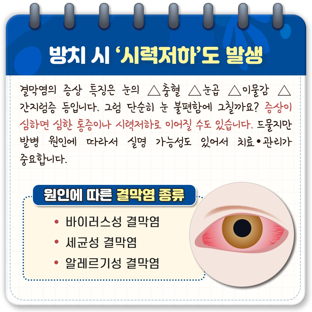 결막염_03.jpg