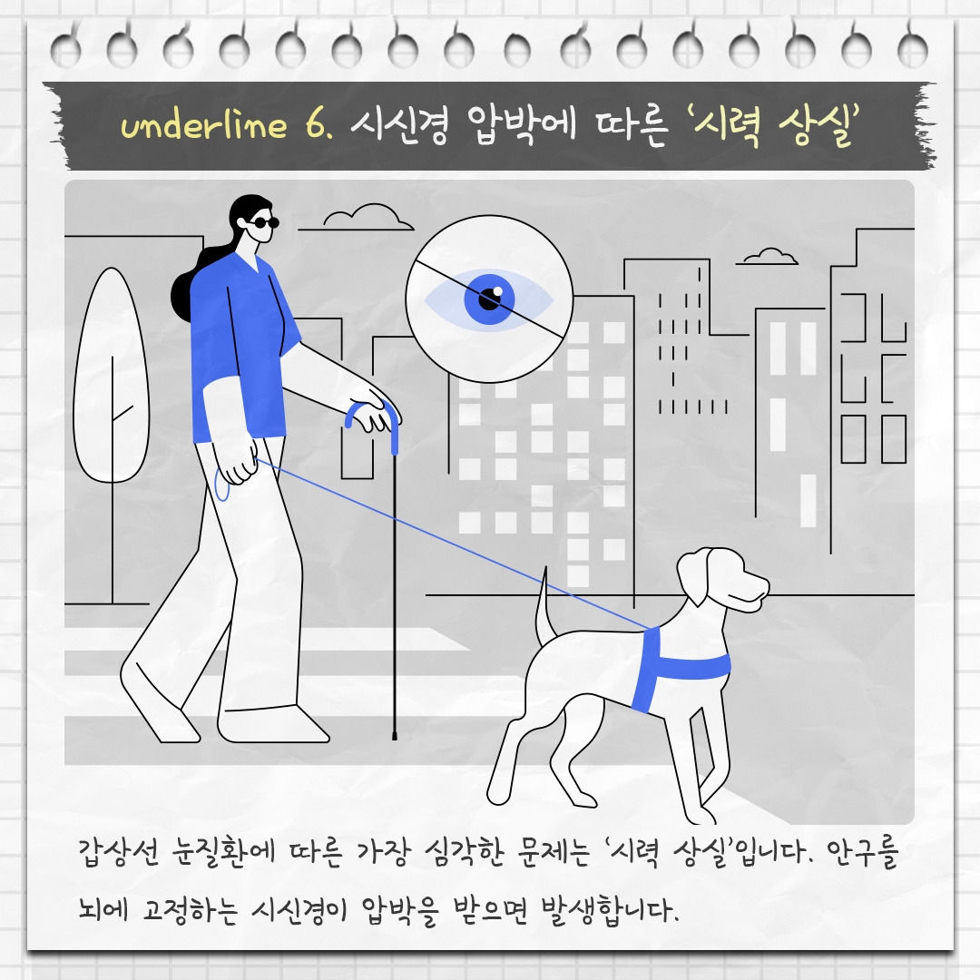 갑상선 눈질환_09 .jpg