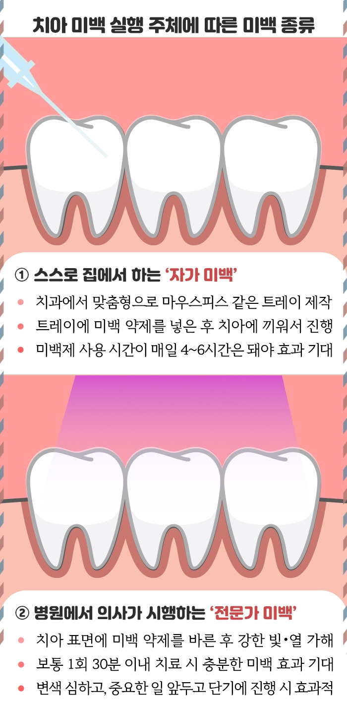 치아미백_6 .jpg