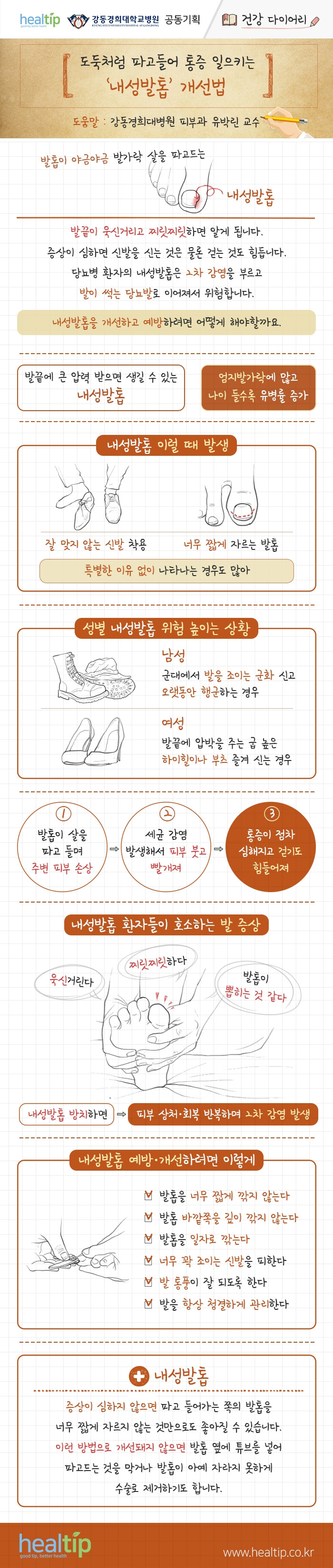 도둑처럼 파고들어 통증 일으키는 ‘내성발톱’ 개선법_힐팁_191121.jpg