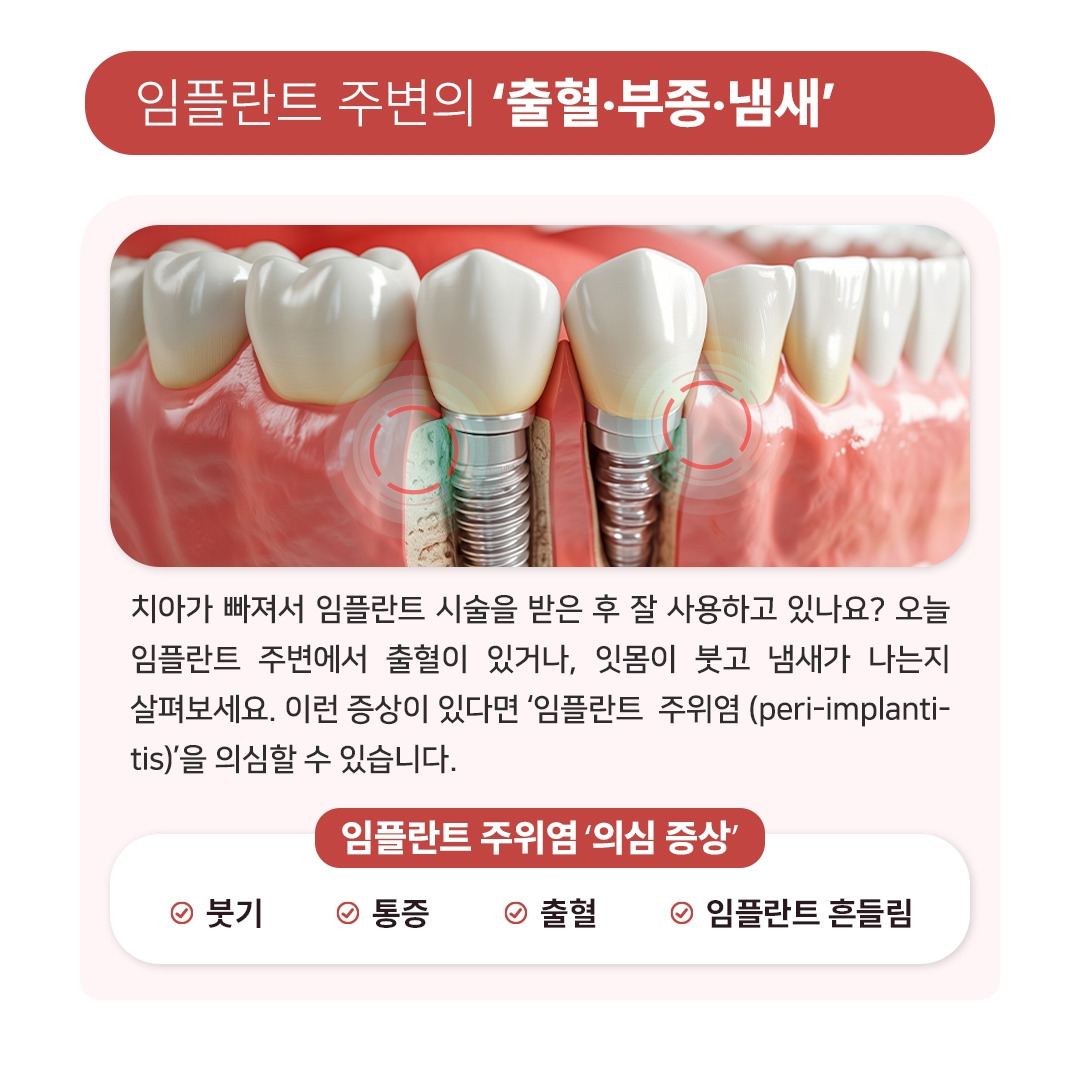 임플란트주위염_02.jpg