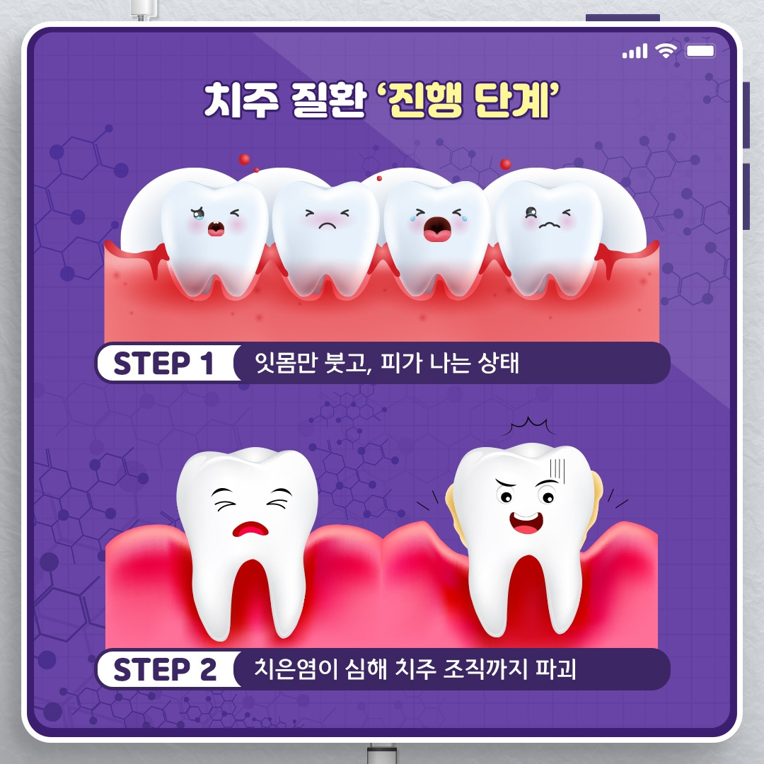 치주질환_03.jpg
