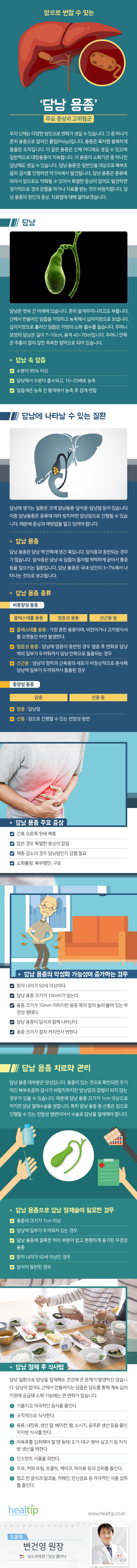 헬스_암으로-번질-수-있는-‘담낭-용종’-__180804.jpg