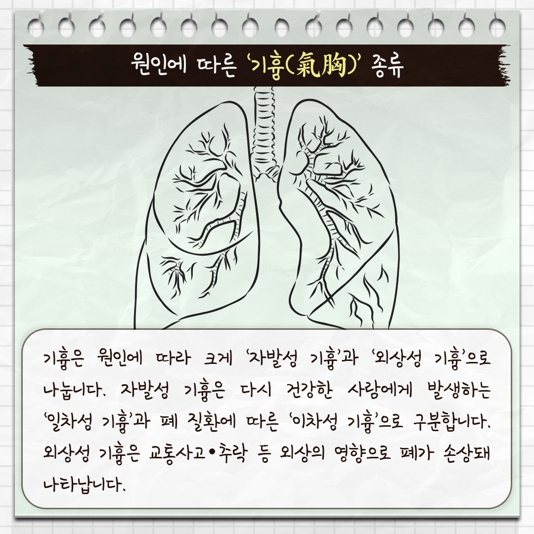 기흉_03.jpg