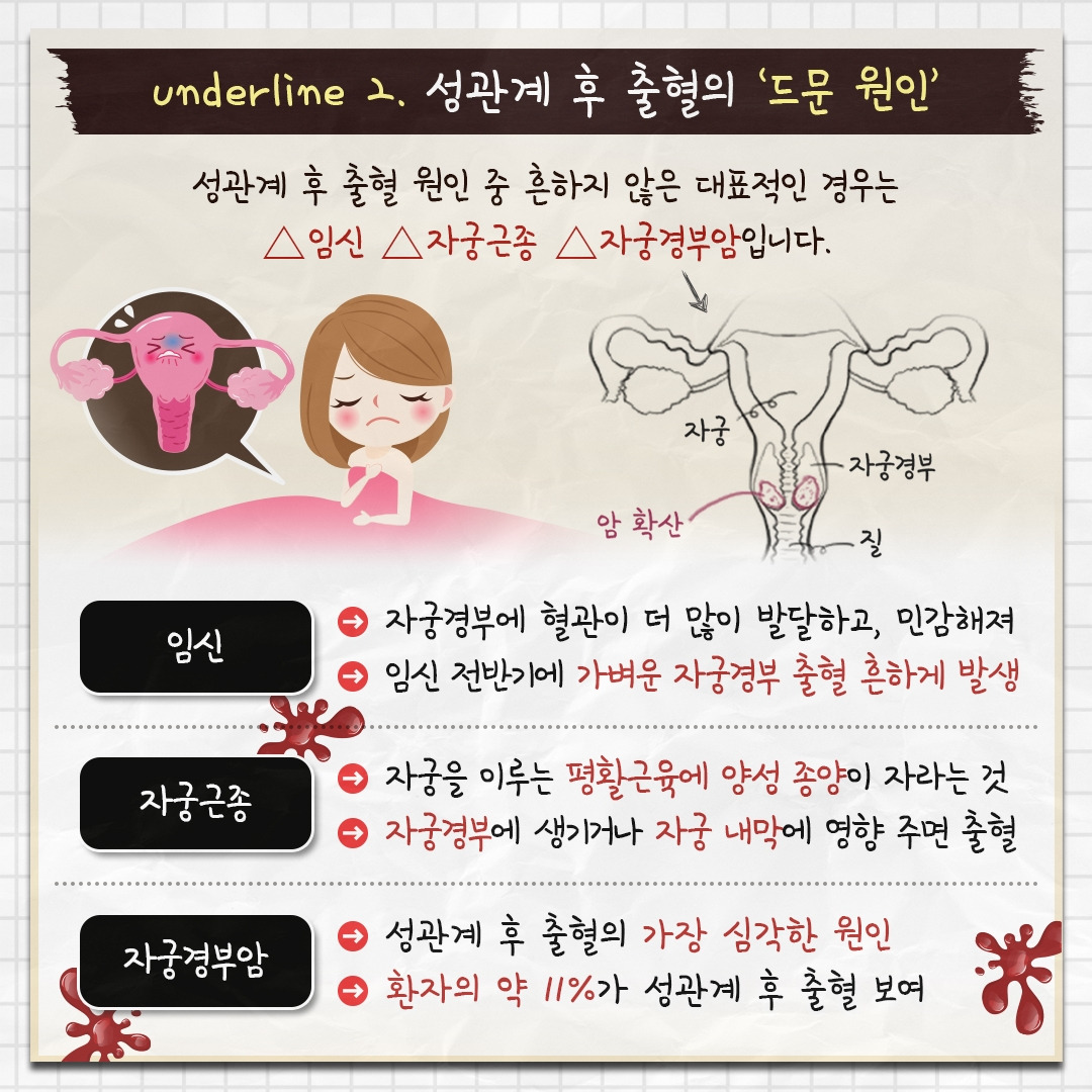 성관계후출혈_04.jpg