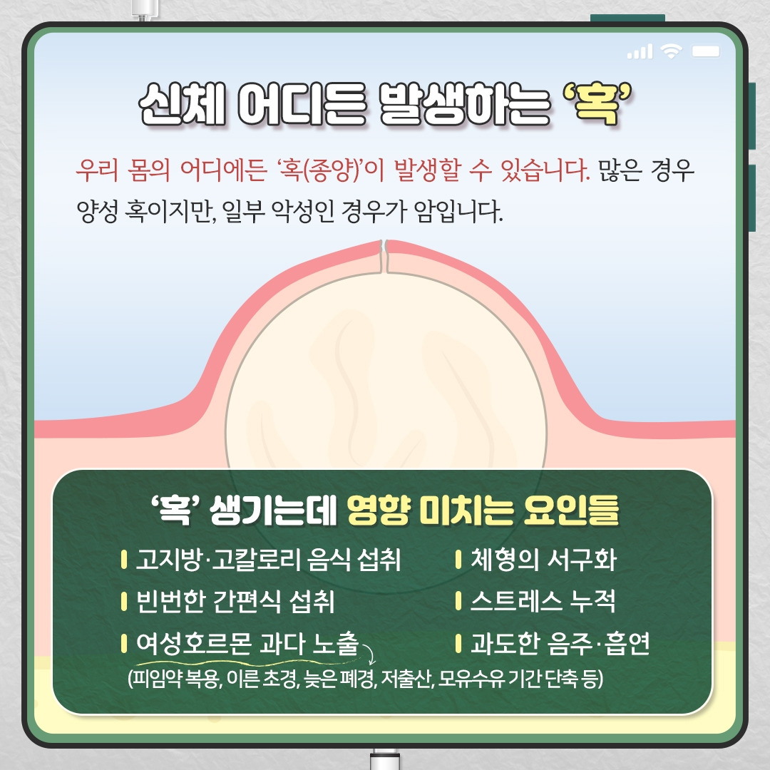 여성혹_02.jpg