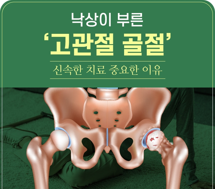 강동경희대병원425-고관절 골절1.jpg