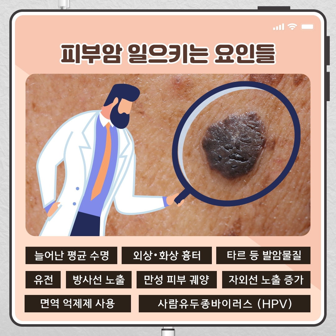 피부암_03 .jpg
