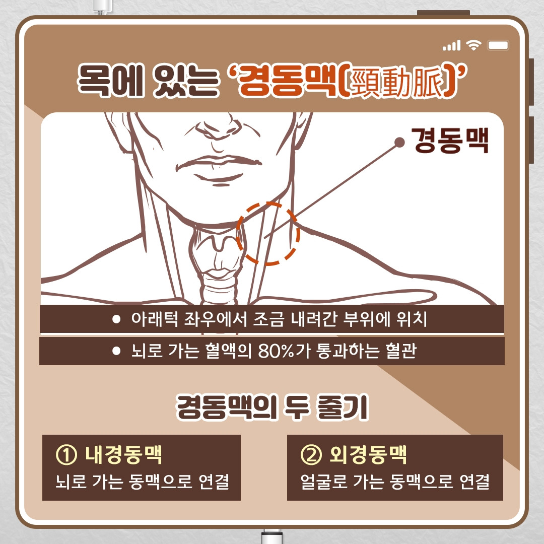 경동맥 협착증_03 .jpg