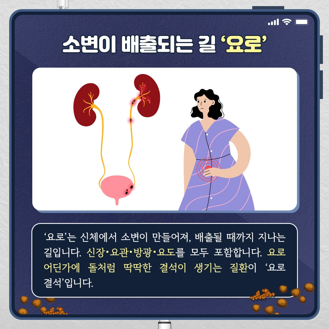요로결석_02.jpg