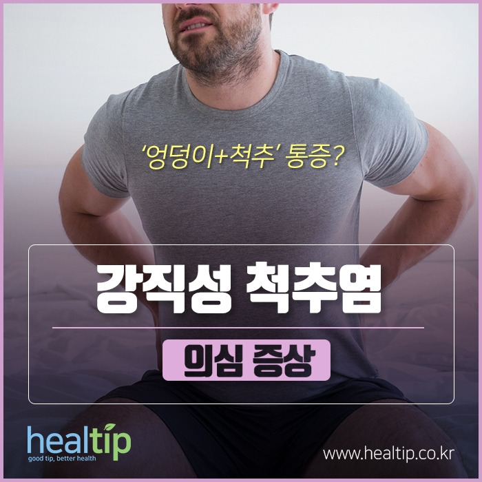 ‘엉덩이척추’ 통증 강직성 척추염 의심 증상1.jpg