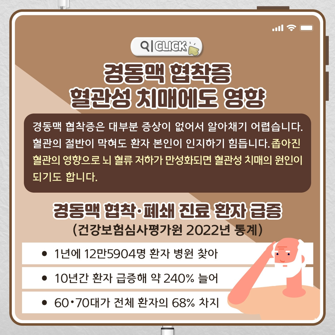 경동맥 협착증_05.jpg