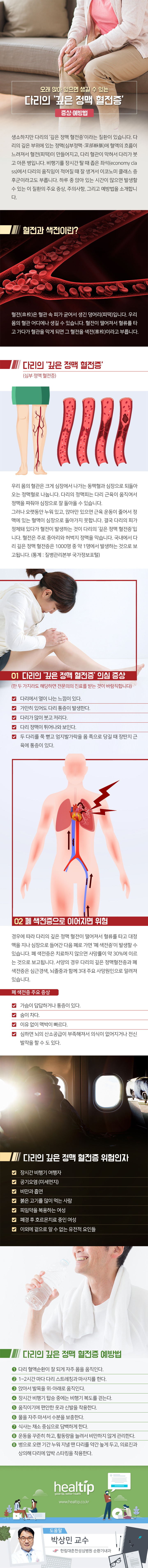 헬스_오래 앉아 있으면 생기는 ‘심부정맥 혈전증’ 증상,예방법2_180321.jpg