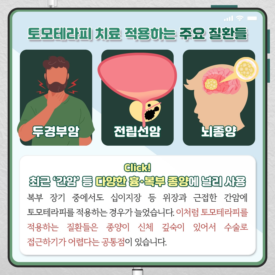 토모테라피_05.jpg