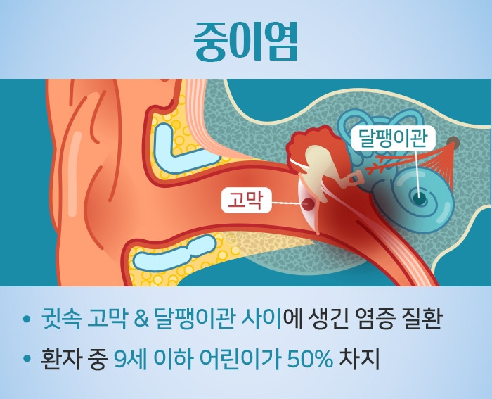 소아 중이염_1.jpg