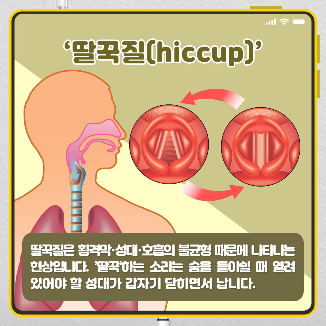 딸꾹질_02.jpg
