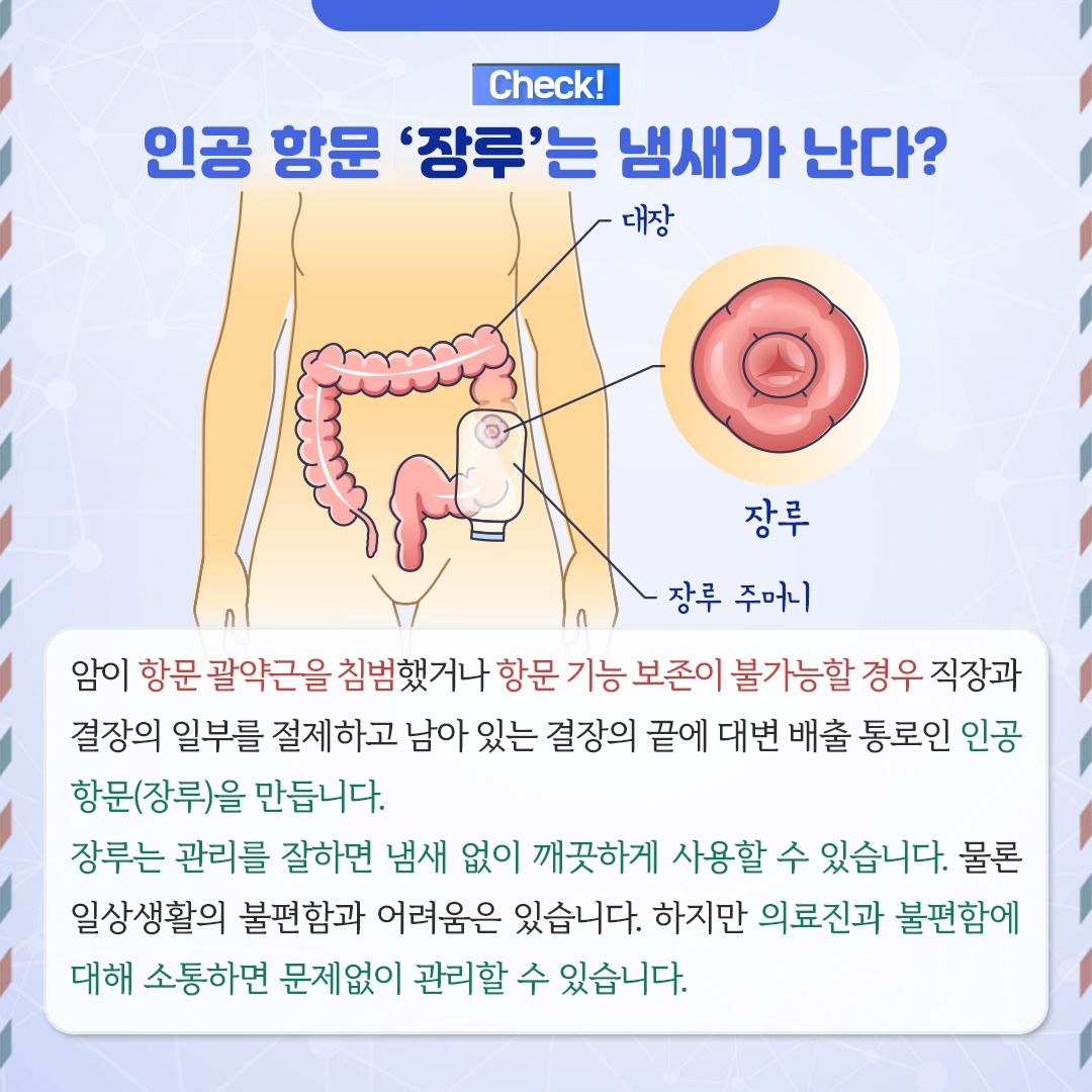 대장암_07.jpg