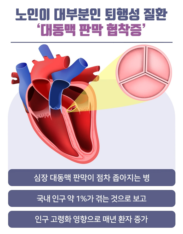 대동맥 판막 협착증_02 .jpg