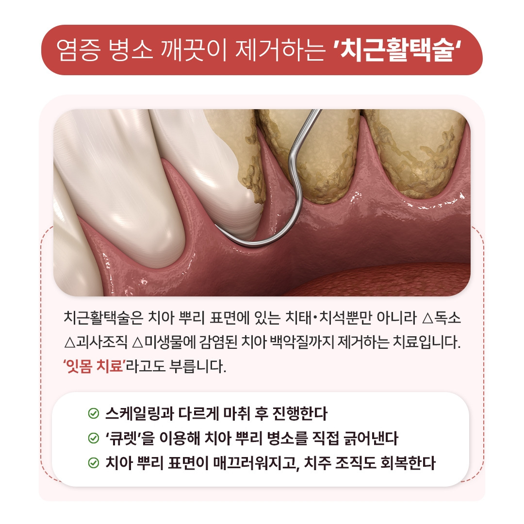 치은염&치주염_05.jpg