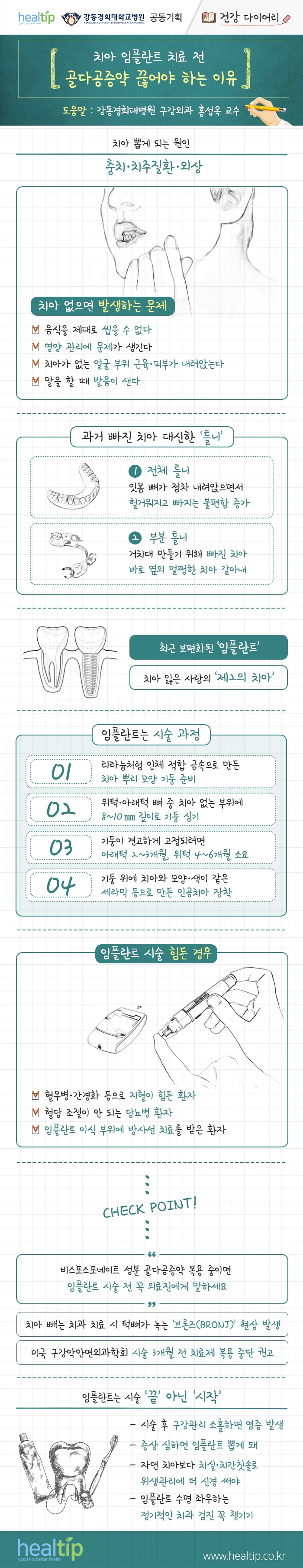 강동경희대병원377-임플란트 골다공증약.jpg
