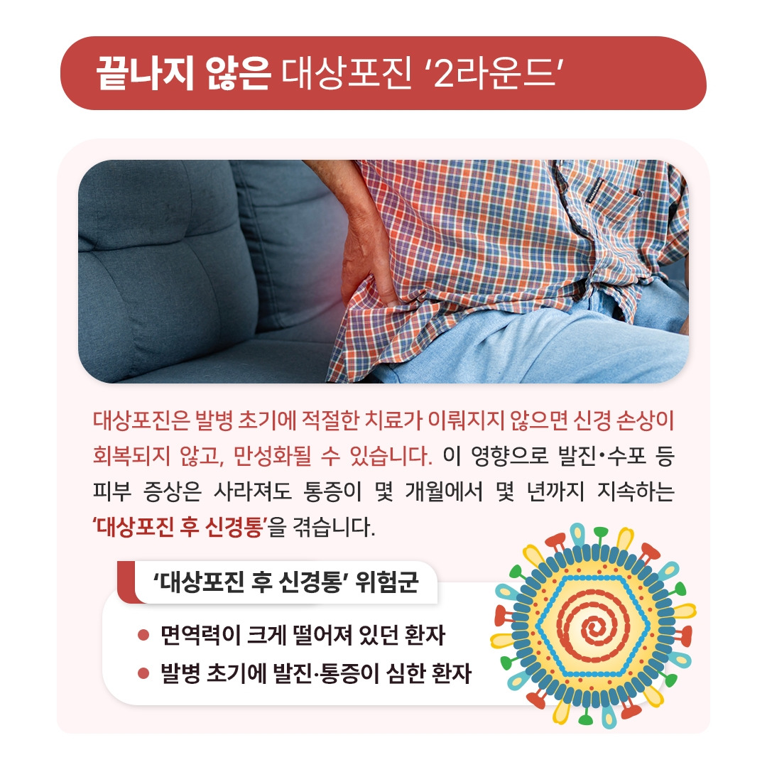 대상포진_05.jpg