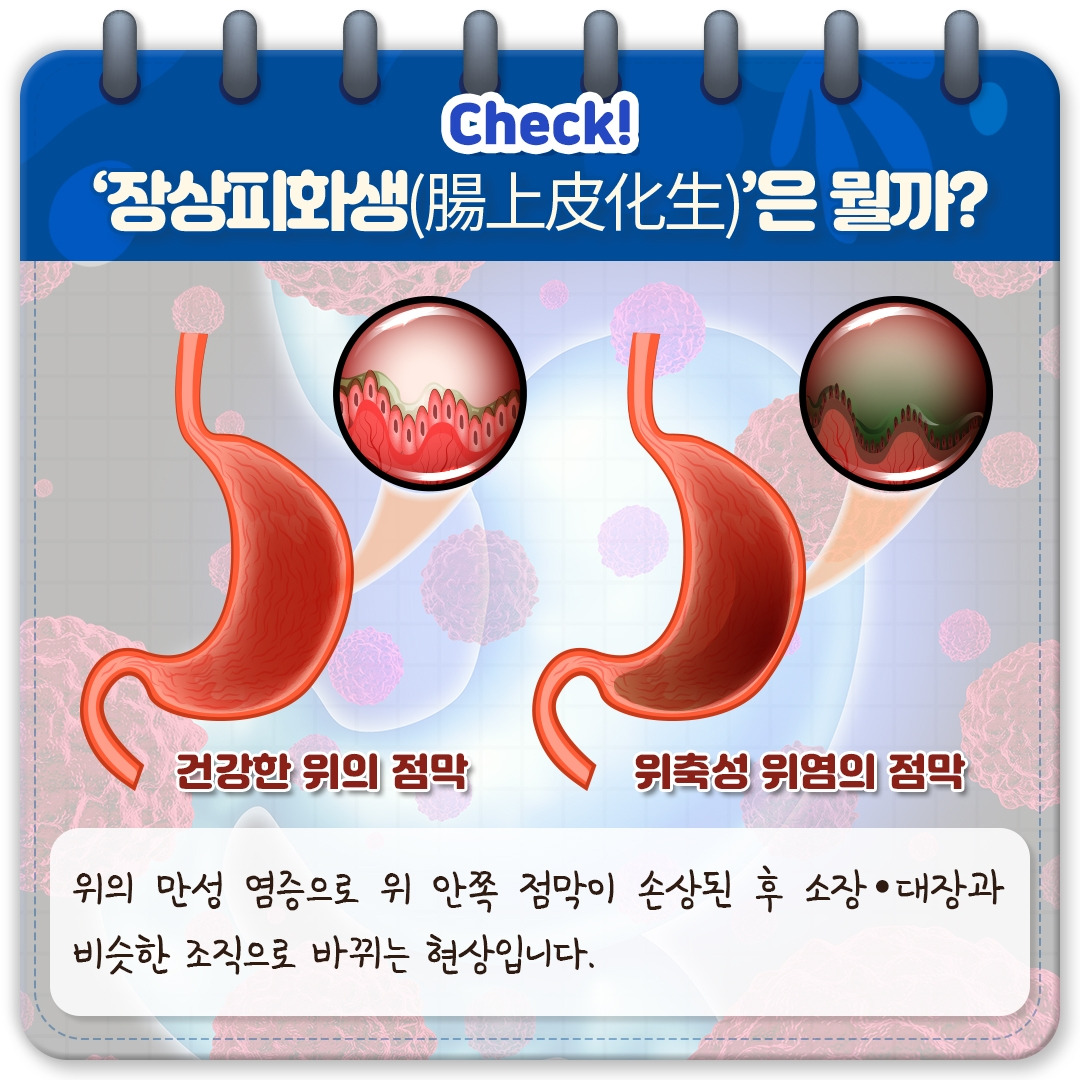 위축성 위염_05.jpg