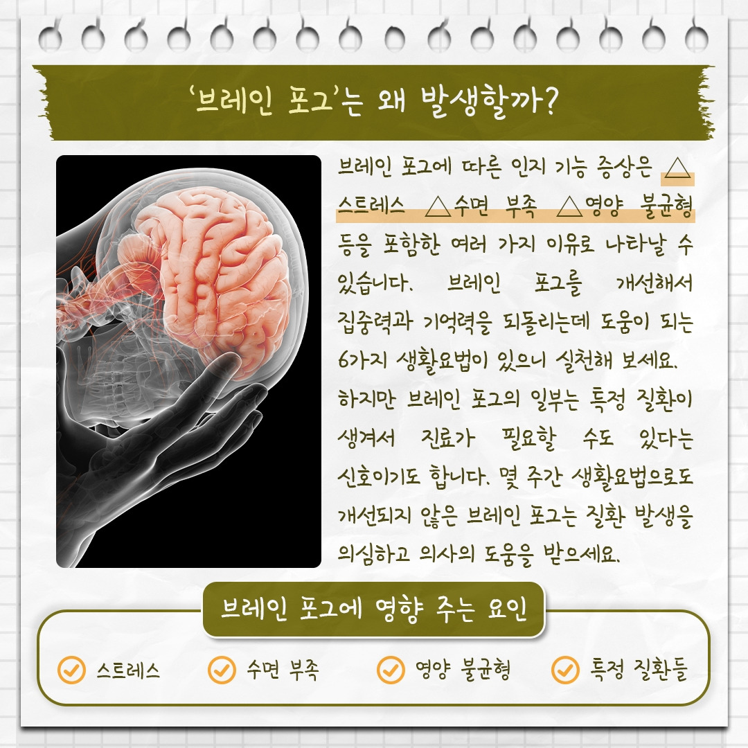 브레인 포그_03 .jpg