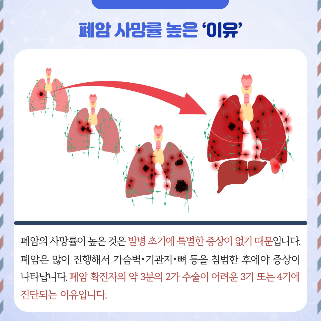 폐암_04.jpg