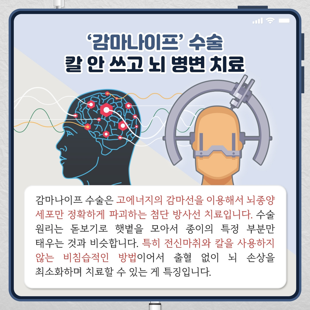 뇌종양 감마나이프수술_03.jpg