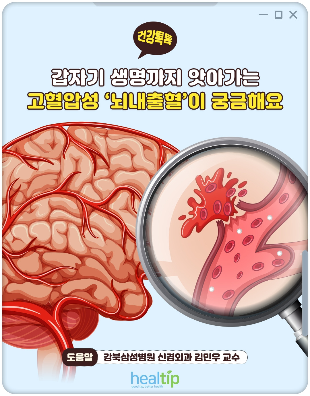뇌내출혈_01_힐팁.jpg