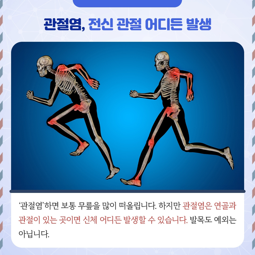 발목관절염_02.jpg