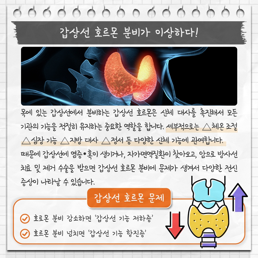 갑상선 눈질환_02 .jpg