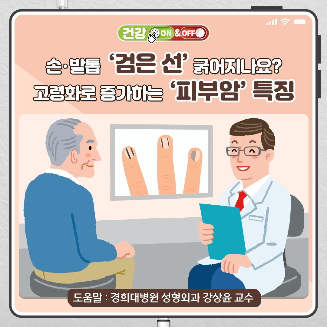 피부암_01_경희.jpg