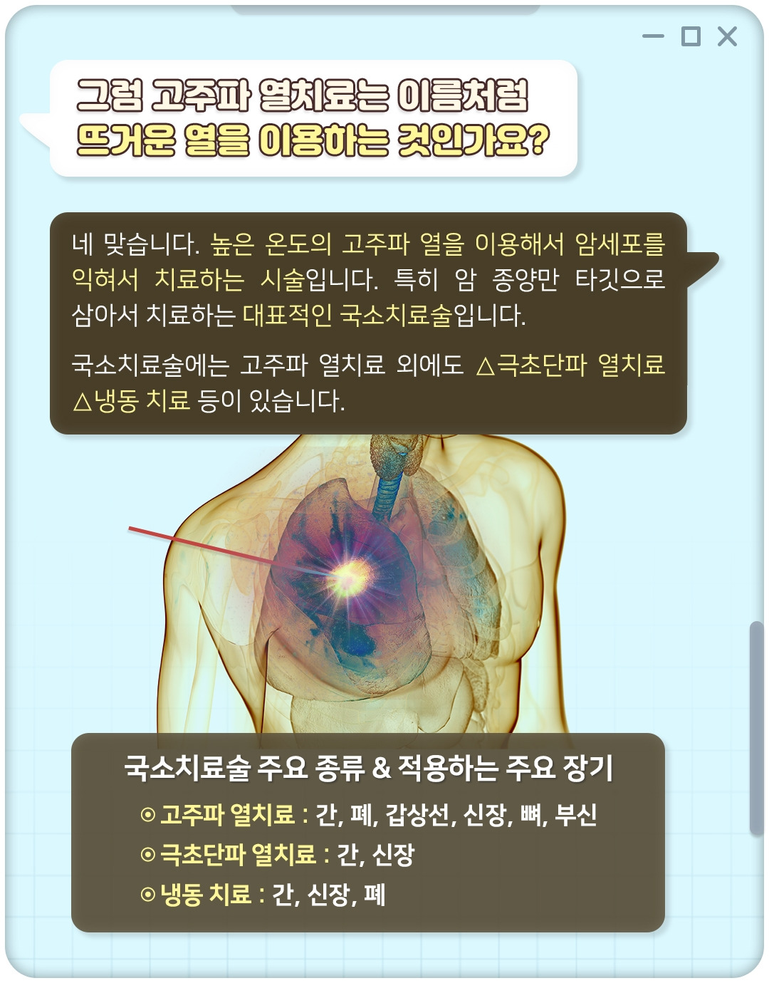 고주파열치료_03.jpg
