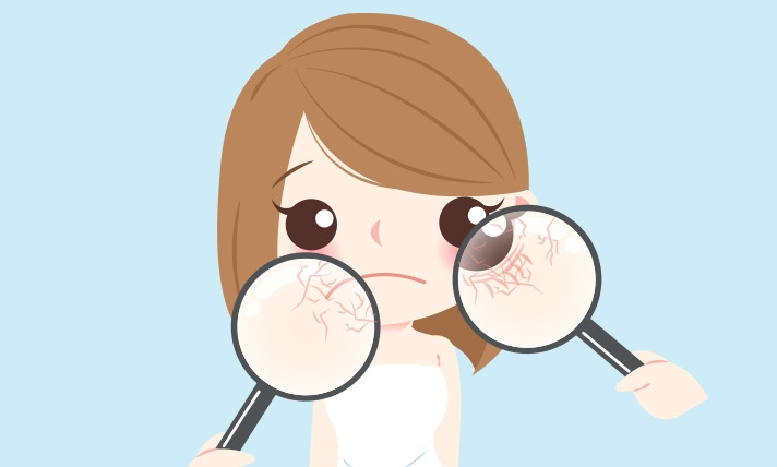 4.▶쇼그렌증후군 주요 증상.jpg