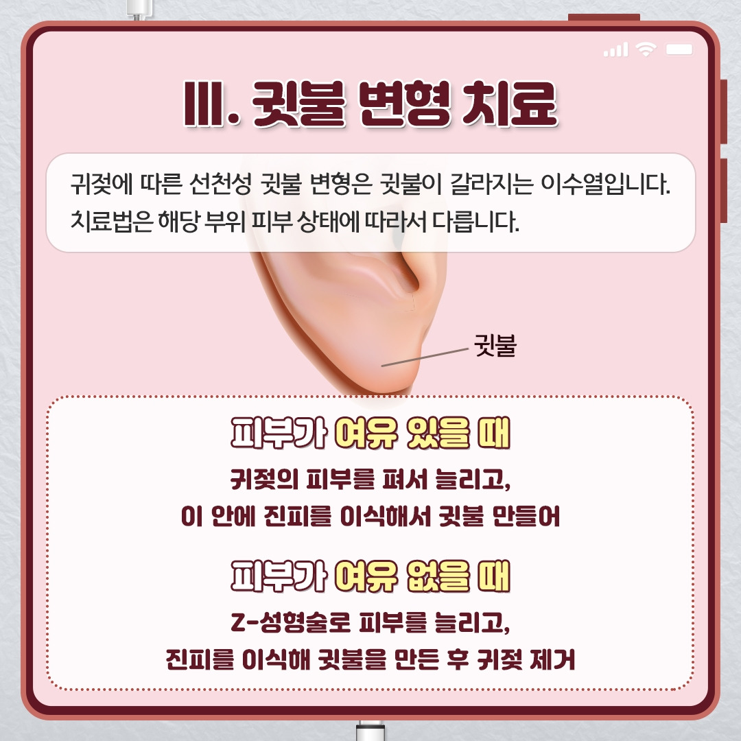 귀젖_09.jpg