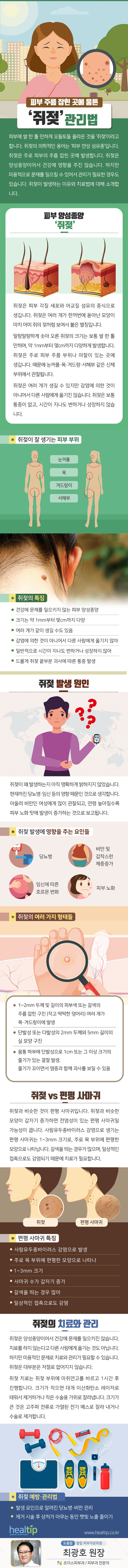 피부 주름 잡힌 곳에 움튼 ‘쥐젖’ 관리법_190929.jpg