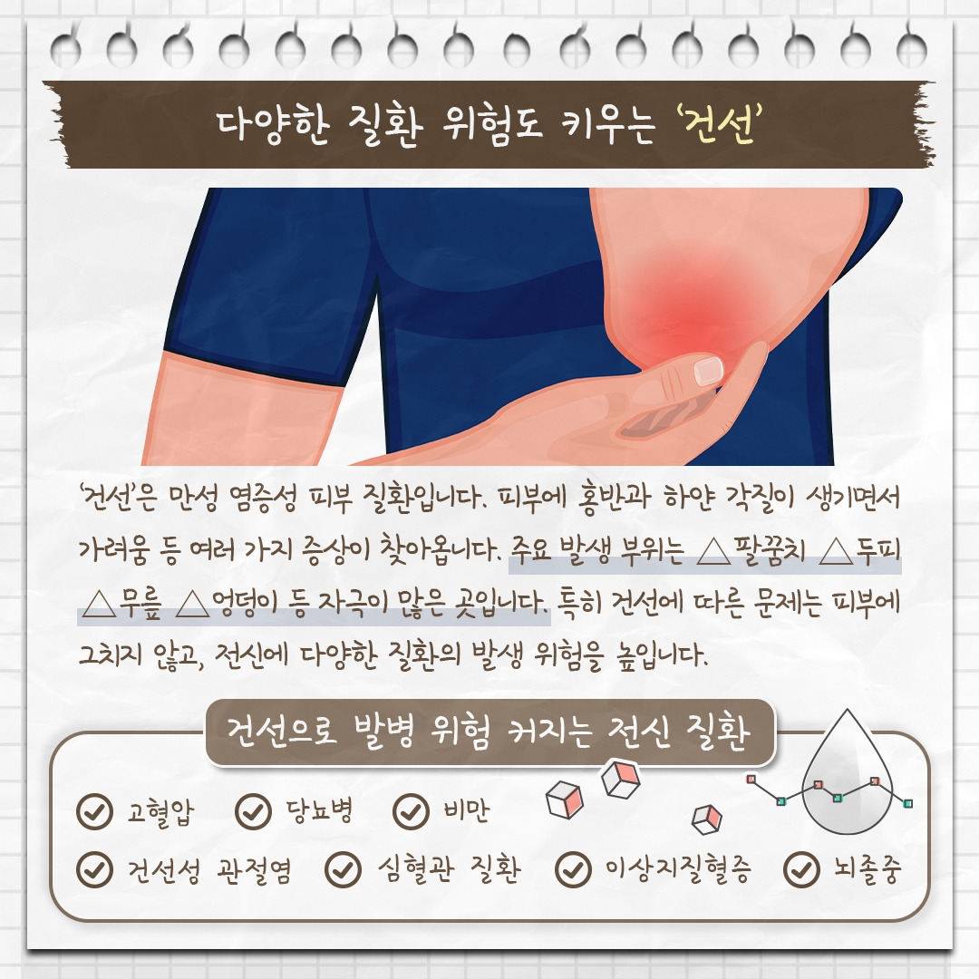 건선성 관절염_02 .jpg