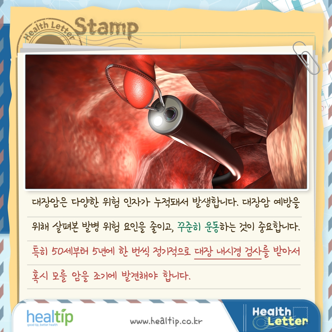대장암_08_힐팁.jpg