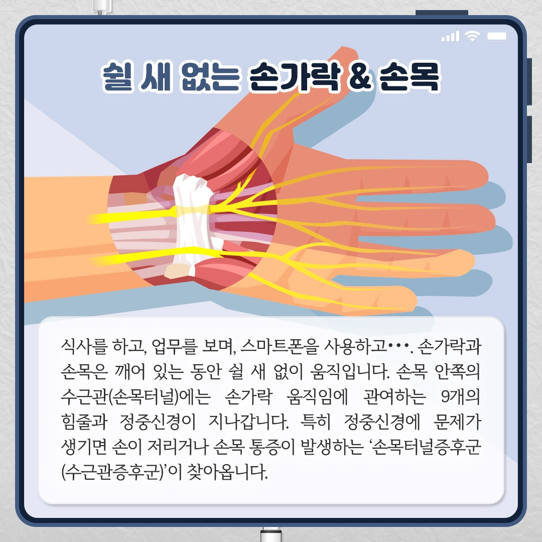 손목터널증후군_02.jpg