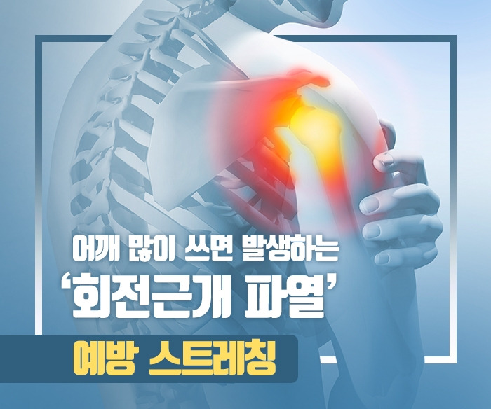190411_어깨 많이 쓰면 발생하는 ‘회전근개 파열’ 예방 스트레칭.jpg