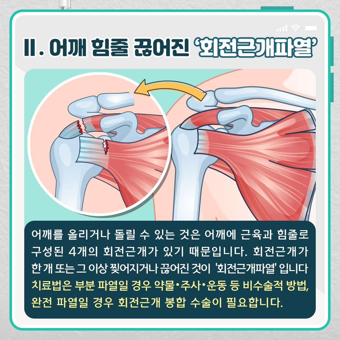 어깨질환_05 .jpg