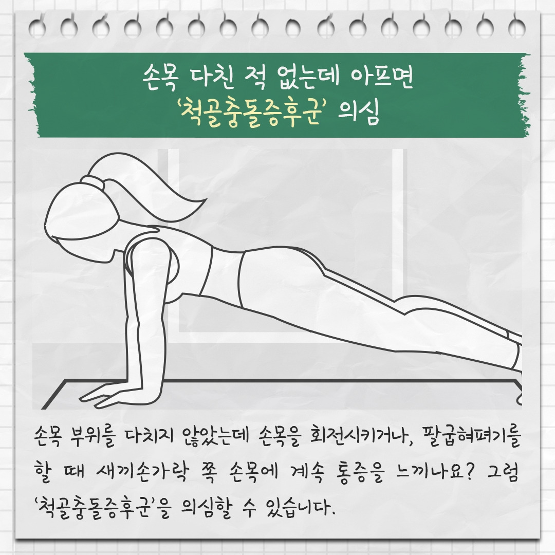 척골충돌증후군 1 .jpg