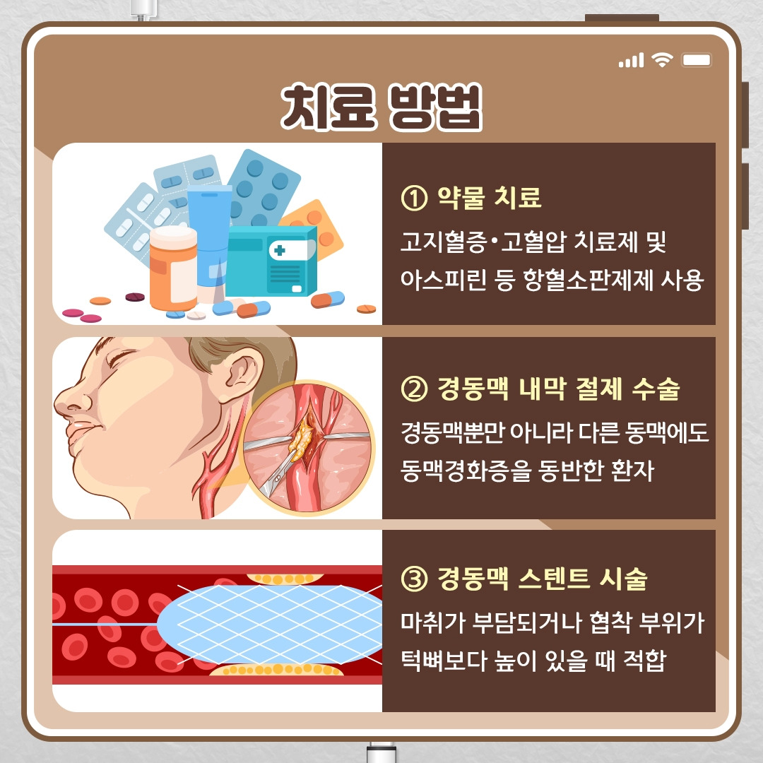경동맥 협착증_09.jpg