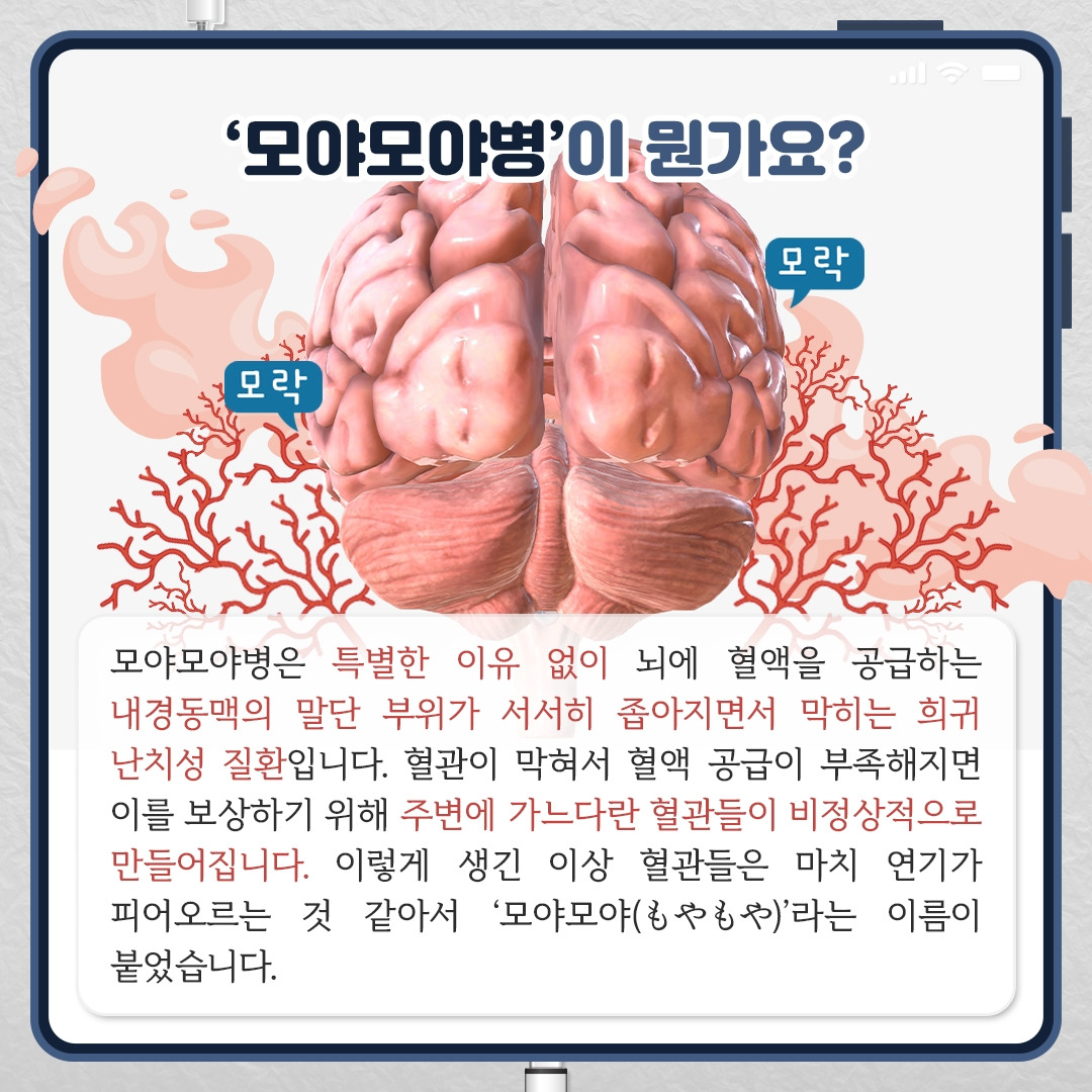 모야모야_02.jpg