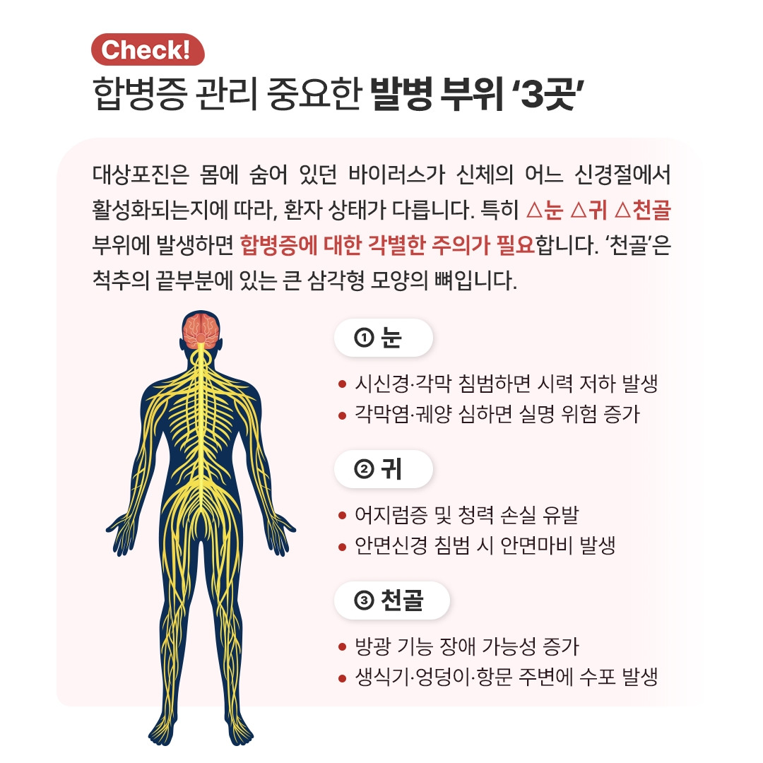 대상포진_06.jpg