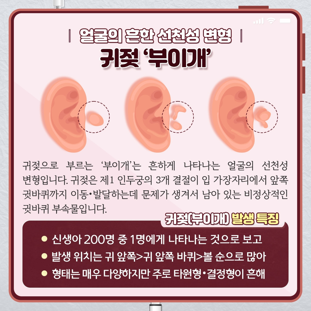귀젖_03.jpg
