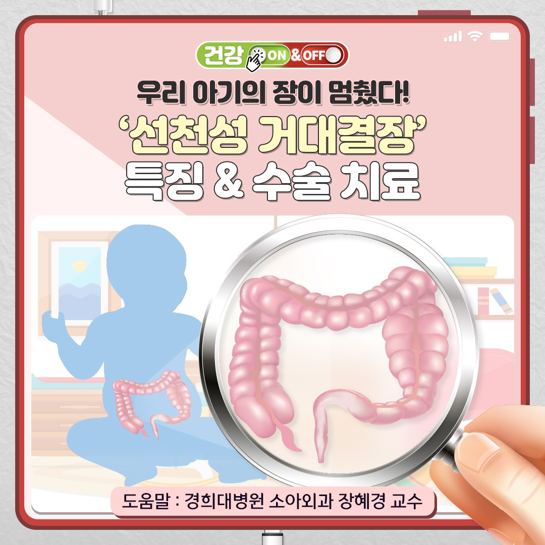 선천성거대결장_01.jpg